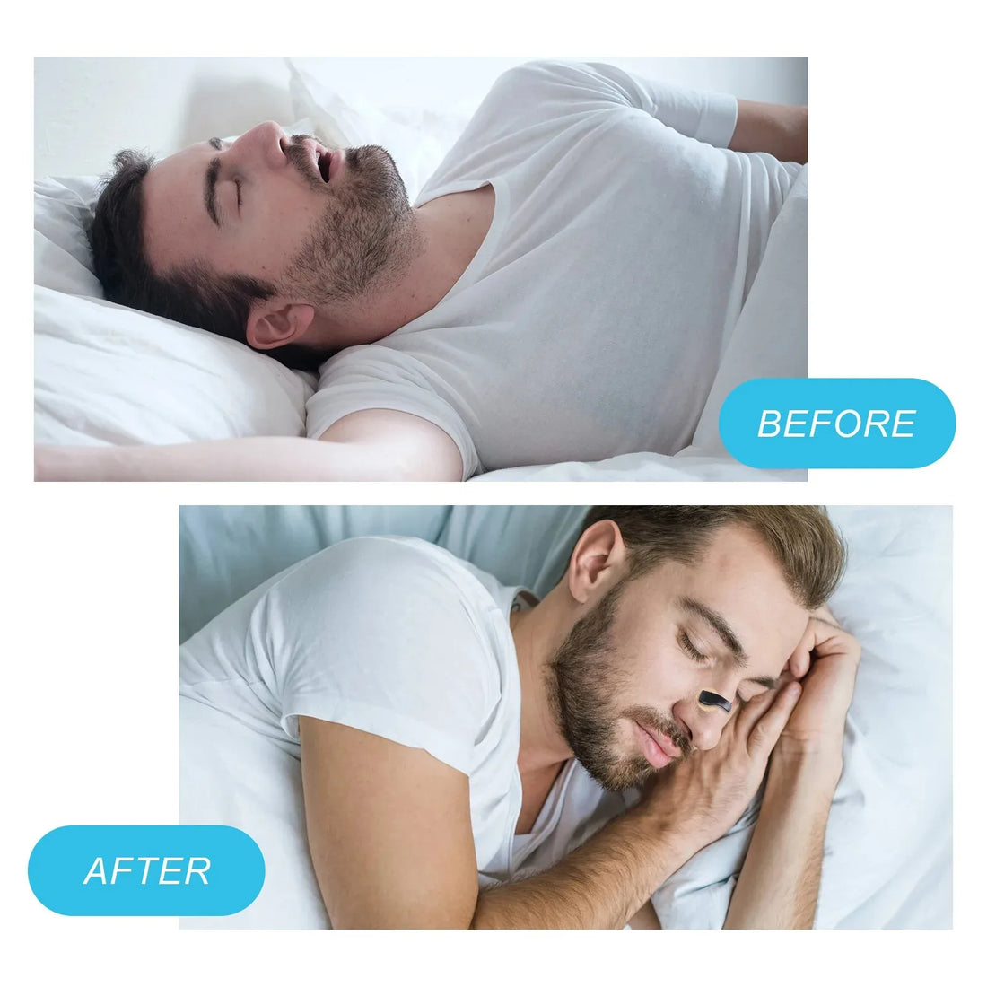 Nasal Breathing